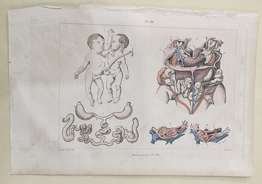 Antique French Natural History Engravings from Guerin Dictionary Monstrosity Anomaly Oddity c1836